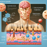 Cypionate de testostérone et risque d'acné